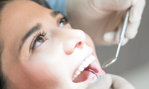 dental services